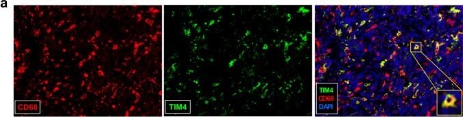 Detection of TIM-4 by Immunohistochemistry
