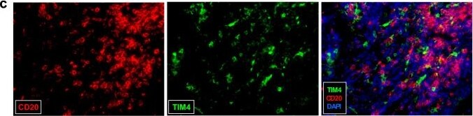 Detection of TIM-4 by Immunohistochemistry