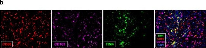 Detection of TIM-4 by Immunohistochemistry