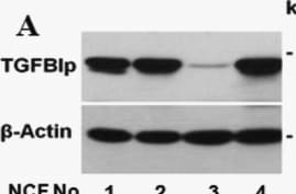 Detection of  beta IG-H3 by Western Blot