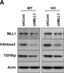 Detection of Human  beta IG-H3 by Western Blot