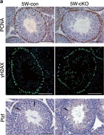 Detection of Mouse PLZF by Western Blot