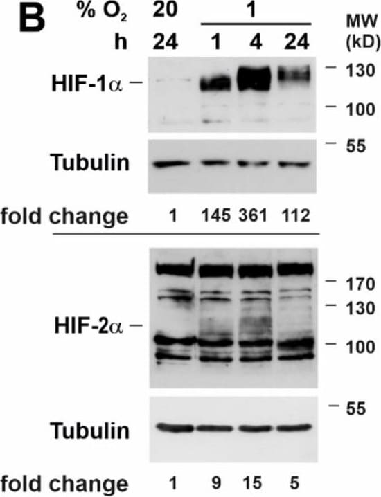 Detection of Mouse HIF-2 alpha/EPAS1 by Western Blot