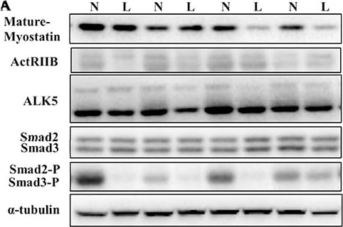 Detection of Porcine TGF-beta RI/ALK-5 by Western Blot