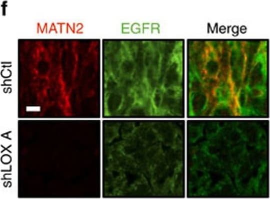 Detection of Mouse Matrilin-2 by Immunohistochemistry