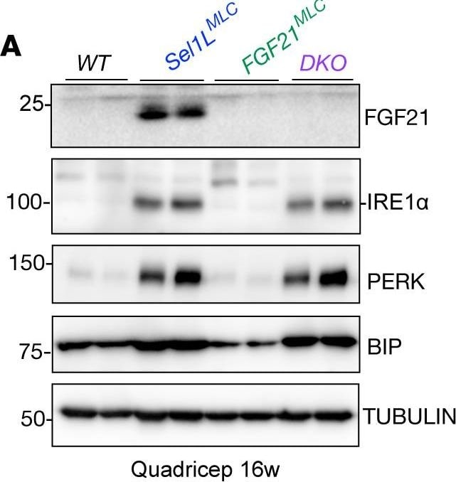 Detection of FGF-21 by Western Blot