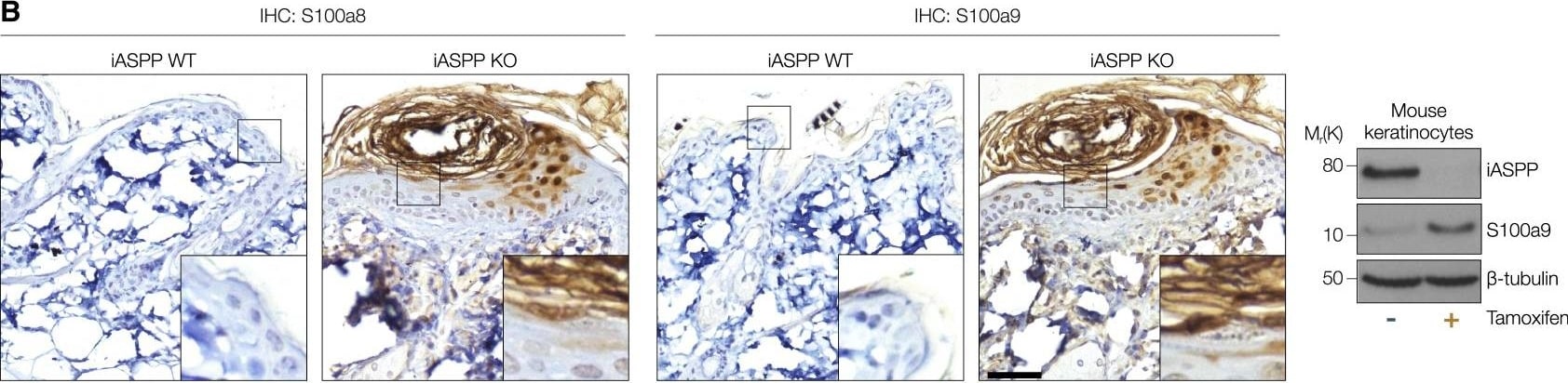 Detection of Mouse S100A8 by Immunohistochemistry