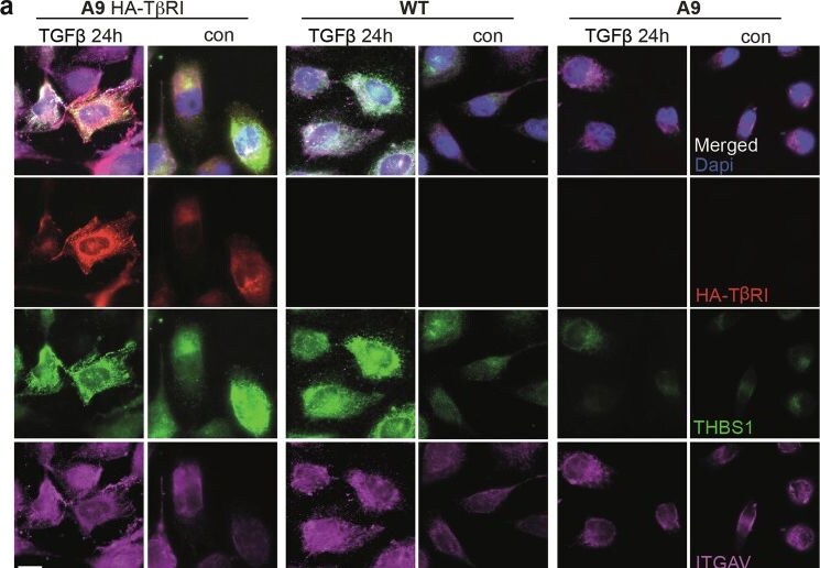 Detection of Thrombospondin-1 by Immunocytochemistry/ Immunofluorescence