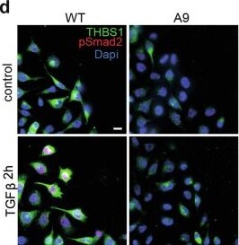 Detection of Thrombospondin-1 by Immunocytochemistry/ Immunofluorescence