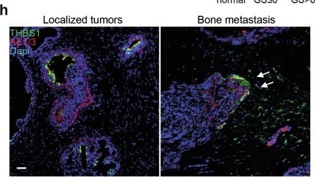 Detection of Thrombospondin-1 by Immunohistochemistry