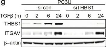 Detection of Thrombospondin-1 by Western Blot