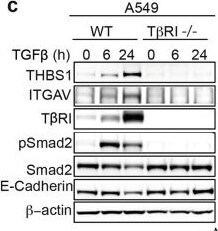 Detection of Thrombospondin-1 by Western Blot