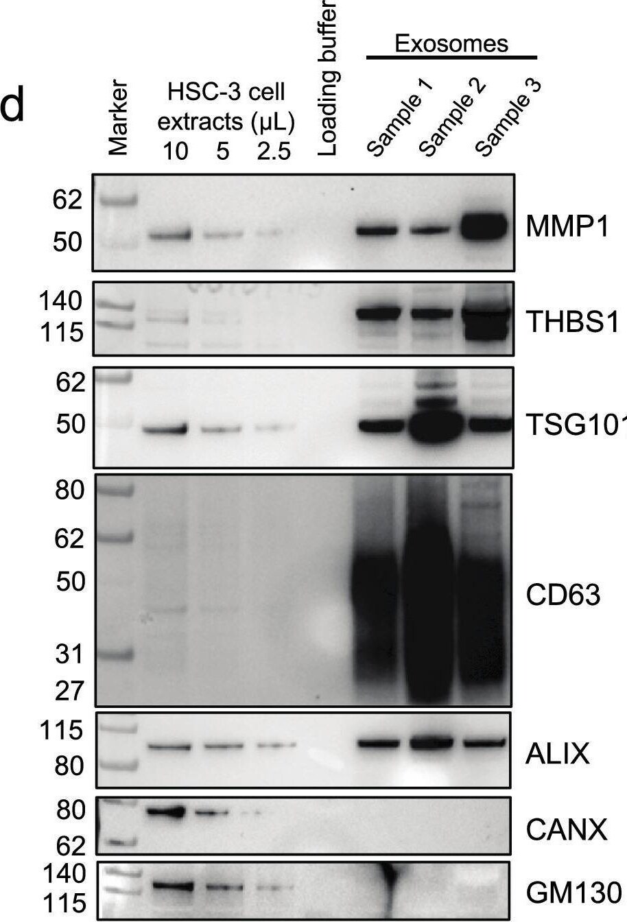 Detection of Thrombospondin-1 by Western Blot