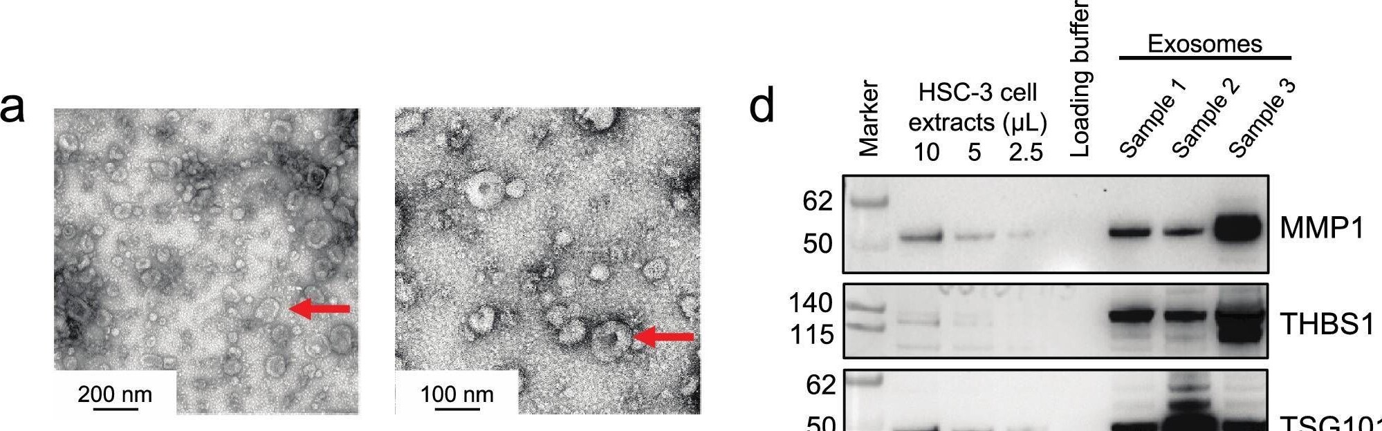 Detection of Thrombospondin-1 by Western Blot