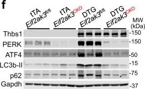 Detection of Thrombospondin-1 by Western Blot