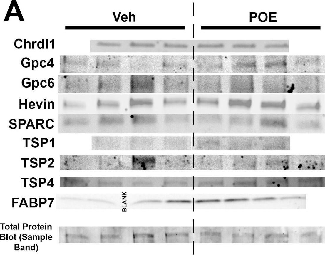 Detection of Thrombospondin-1 by Western Blot