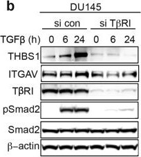 Detection of Thrombospondin-1 by Western Blot