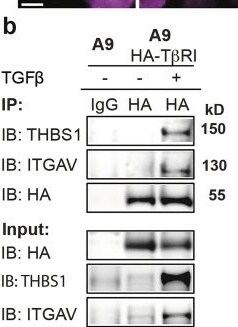 Detection of Thrombospondin-1 by Western Blot