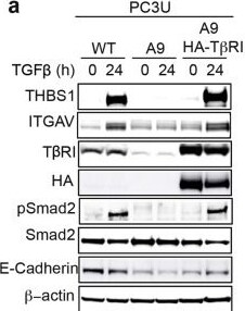 Detection of Thrombospondin-1 by Western Blot
