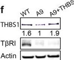 Detection of Thrombospondin-1 by Western Blot