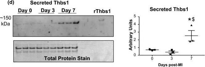 Detection of Thrombospondin-1 by Western Blot