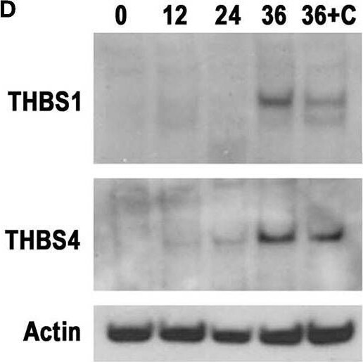 Detection of Thrombospondin-1 by Western Blot
