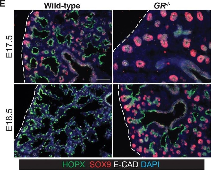 Detection of Mouse Human SOX9 Antibody by Immunohistochemistry