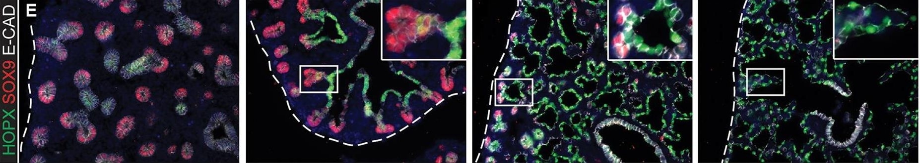 Detection of Mouse Human SOX9 Antibody by Immunohistochemistry