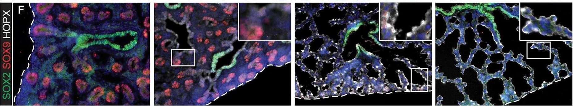Detection of Mouse Human SOX9 Antibody by Immunohistochemistry
