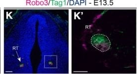 Detection of ROBO3 by Immunohistochemistry