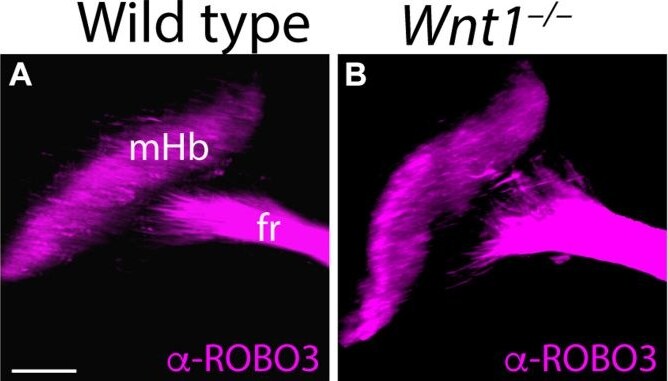 Detection of ROBO3 by Immunohistochemistry