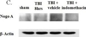 Detection of Rat Nogo-A by Western Blot