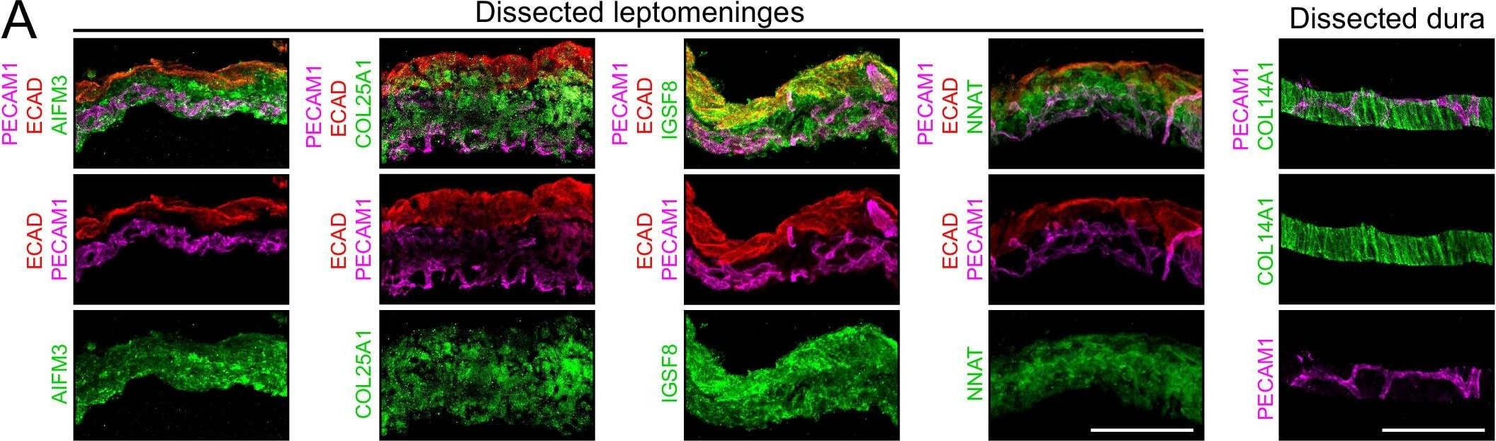 Detection of IGSF8/CD316 by Immunohistochemistry