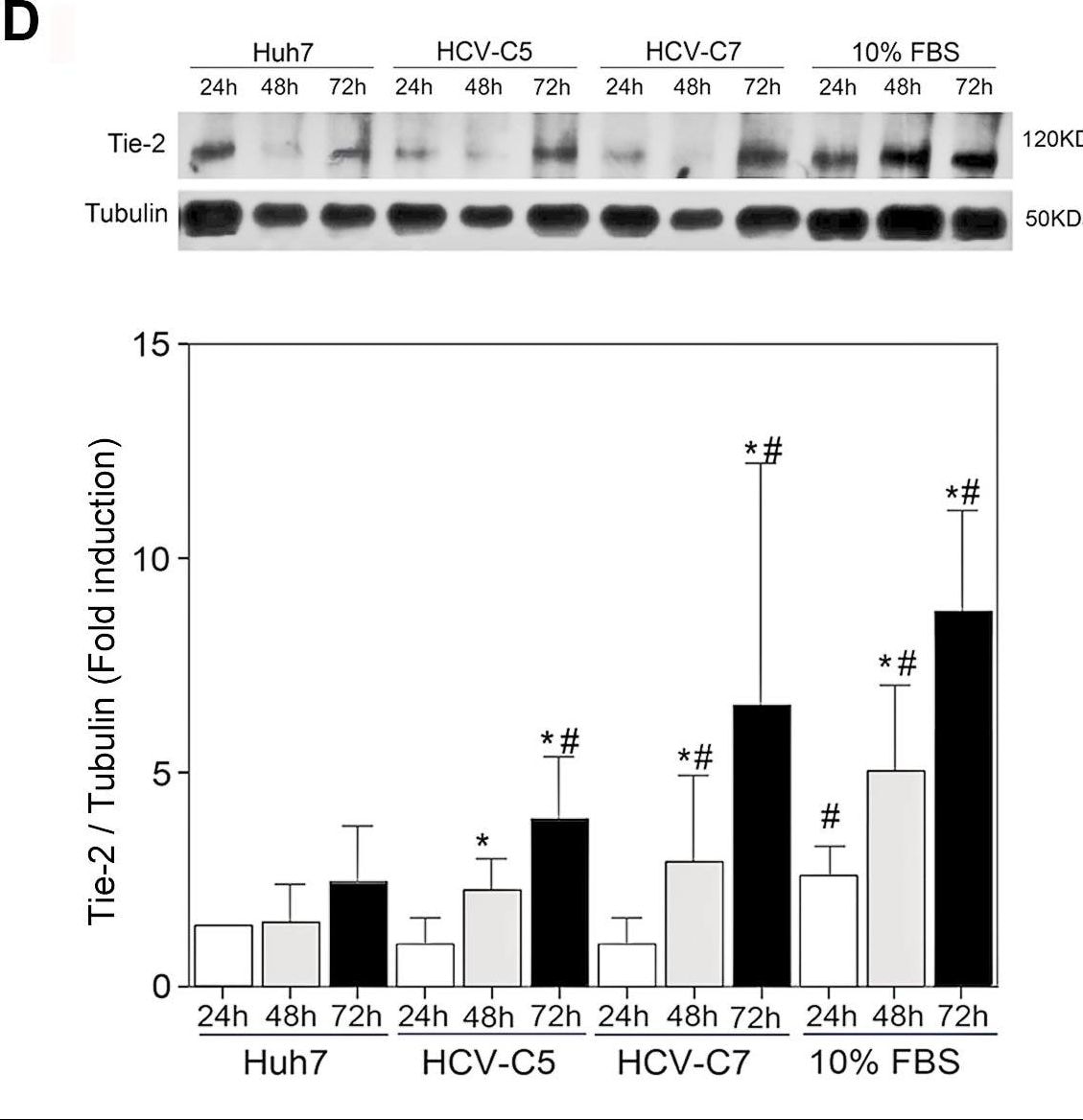 Detection of Human Tie-2 by Western Blot