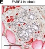 Detection of FABP4 by Immunohistochemistry