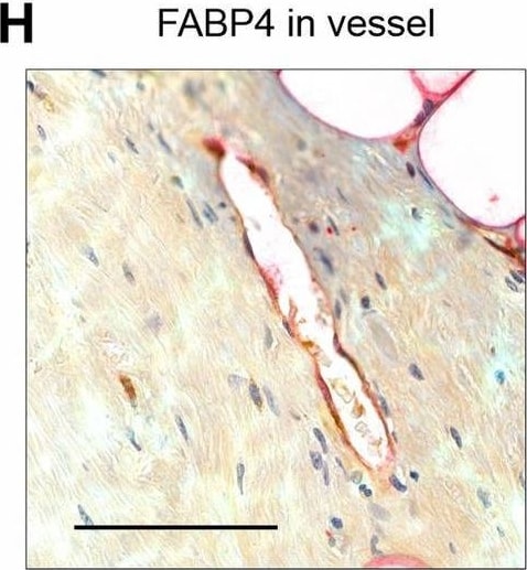 Detection of FABP4 by Immunohistochemistry