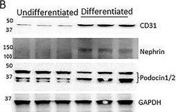 Detection of Mouse Nephrin by Western Blot
