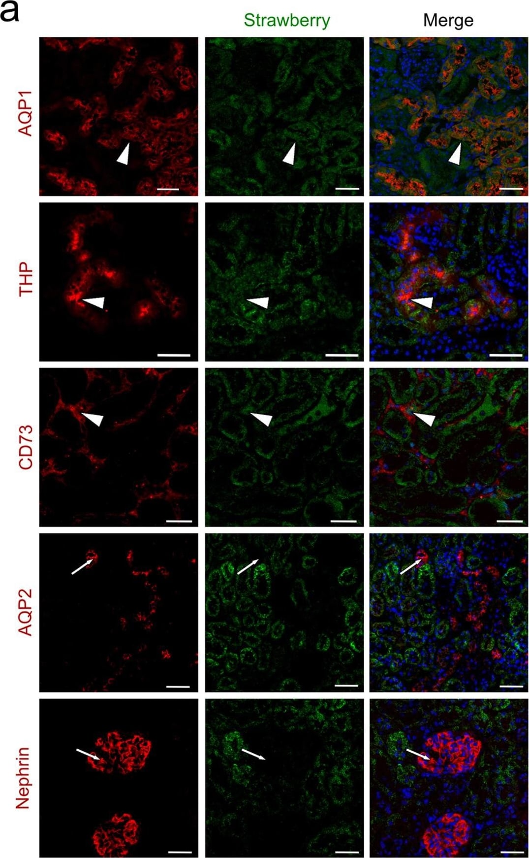 Detection of Mouse Nephrin by Immunocytochemistry/Immunofluorescence