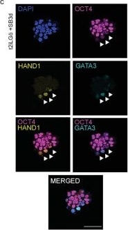 Detection of HAND1 by Immunocytochemistry/ Immunofluorescence