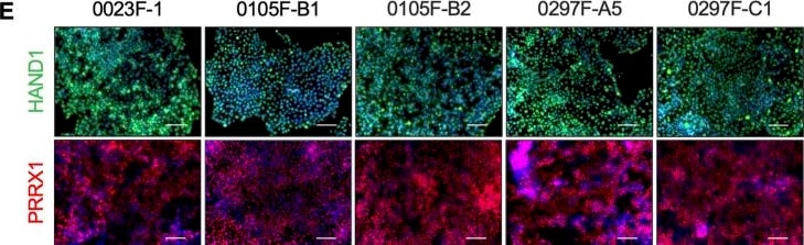 Detection of HAND1 by Immunohistochemistry
