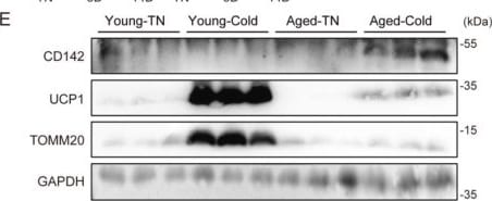 Detection of Coagulation Factor III/Tissue Factor by Western Blot