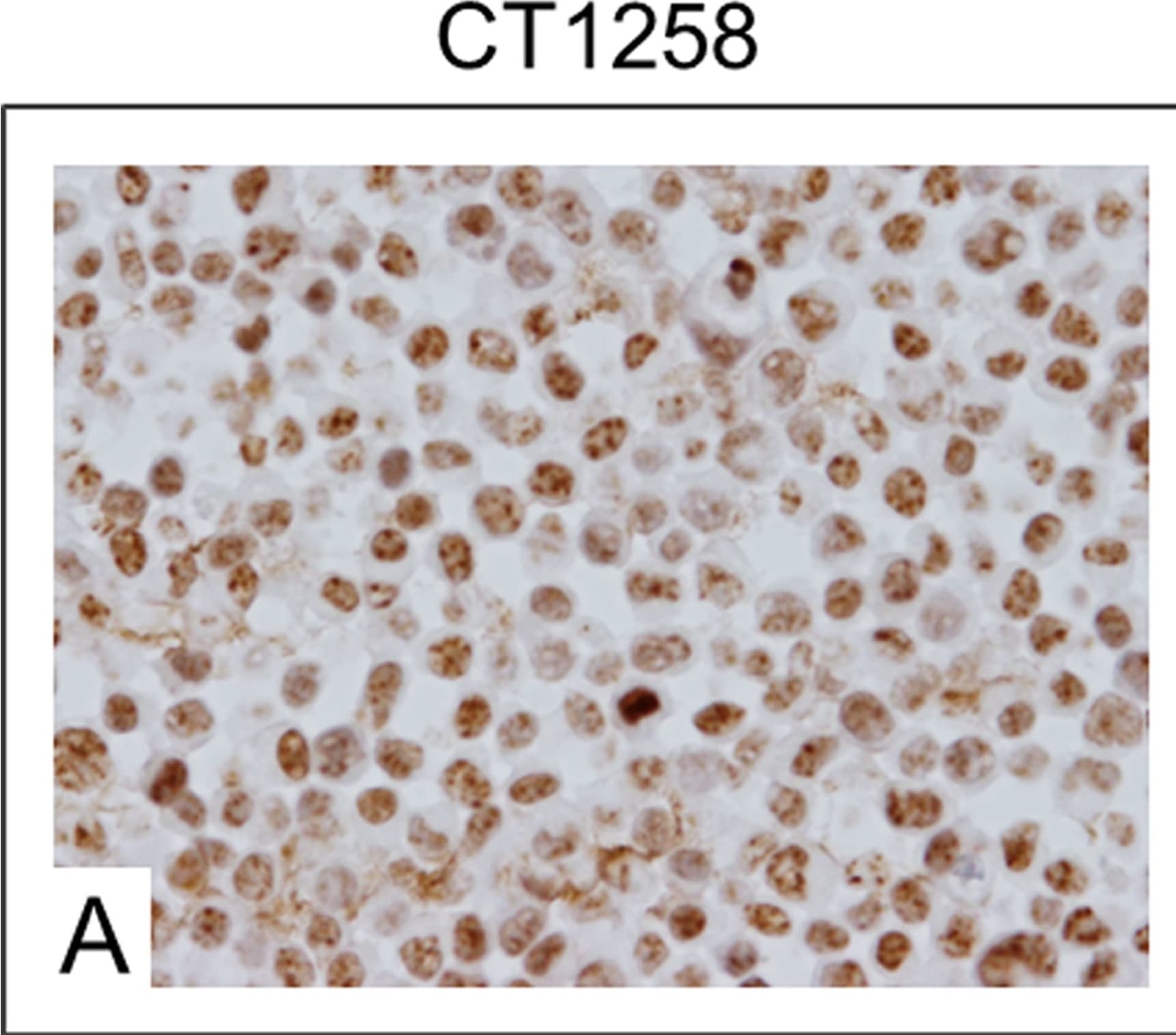 Detection of Canine HMGA2 by Immunocytochemistry/Immunofluorescence