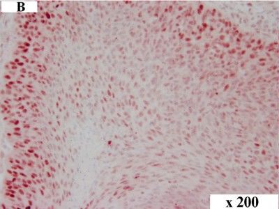 Detection of Canine HMGA2 by Immunocytochemistry/Immunofluorescence