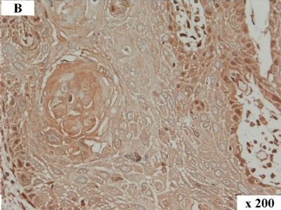 Detection of Human HMGA2 by Immunocytochemistry/Immunofluorescence