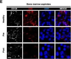 Detection of Syndecan-1 by Immunocytochemistry/ Immunofluorescence