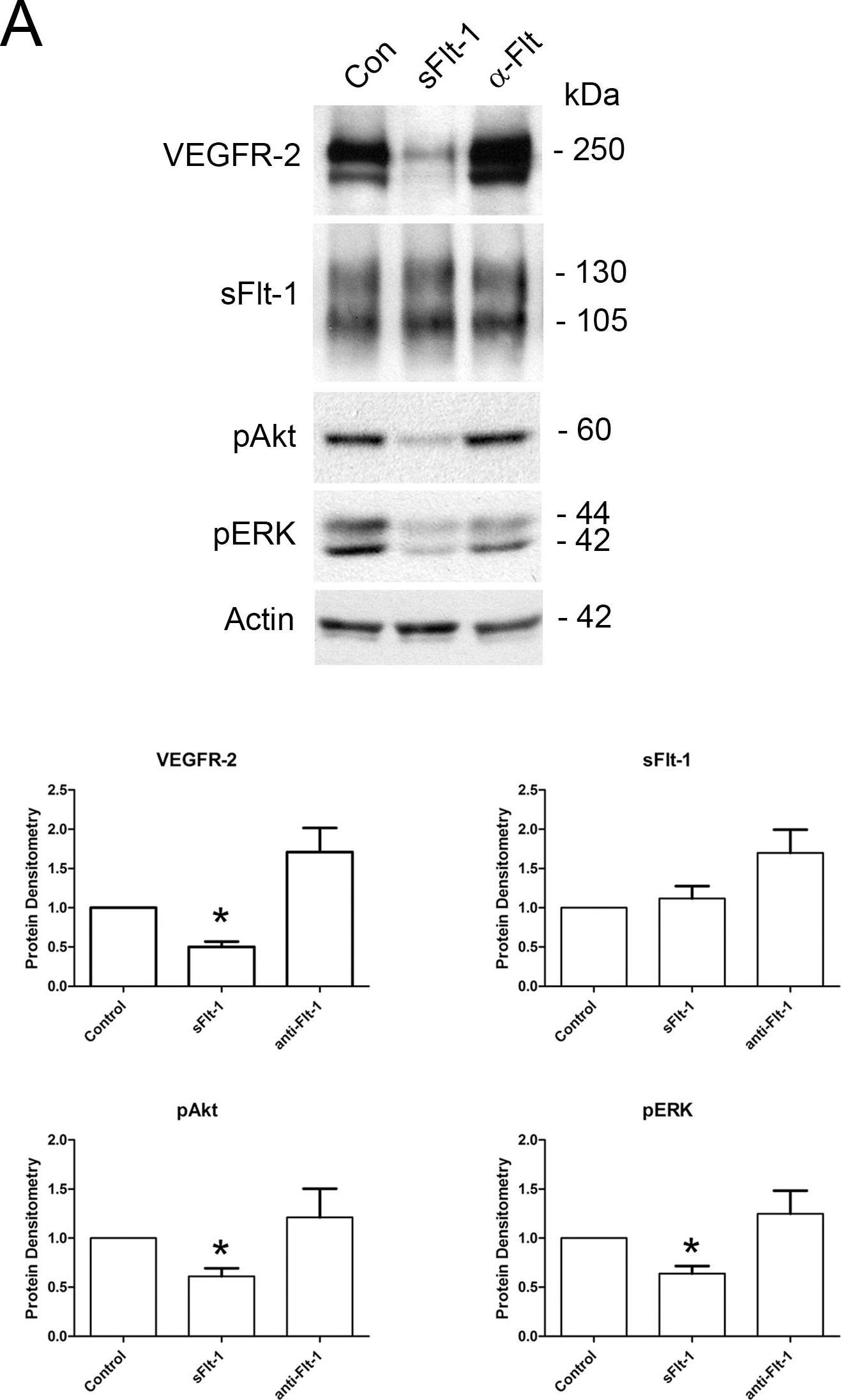 Detection of VEGFR1/Flt-1 by Western Blot