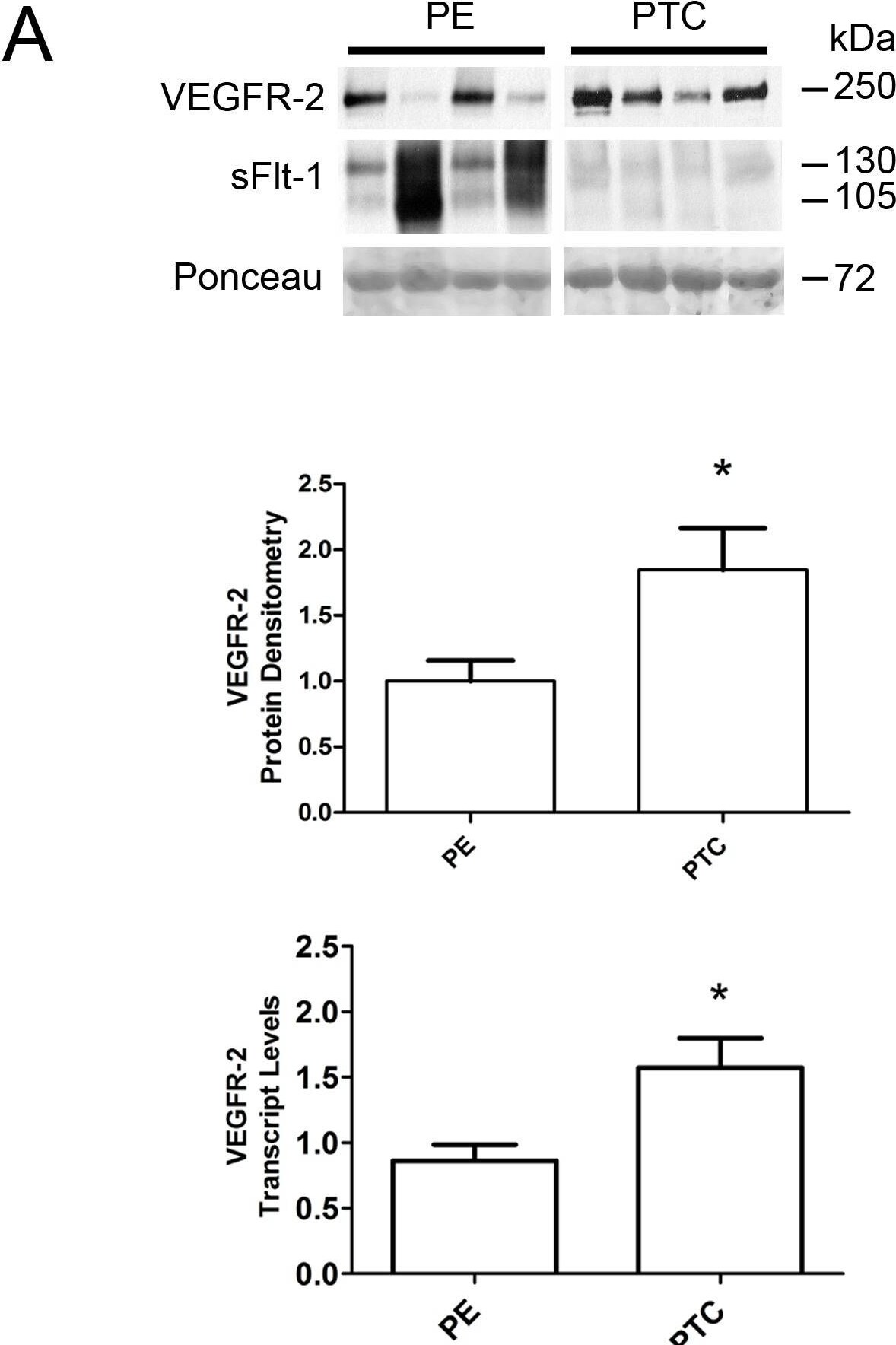 Detection of VEGFR1/Flt-1 by Western Blot