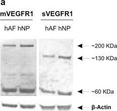 Detection of Human VEGFR1/Flt-1 by Western Blot