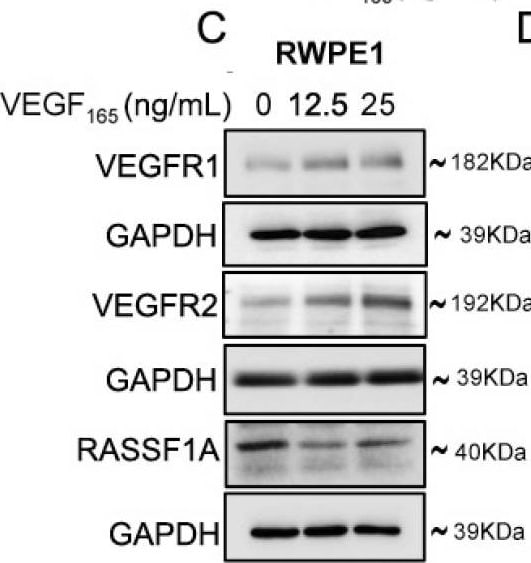 Detection of Human VEGFR1/Flt-1 by Western Blot