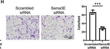 Detection of Semaphorin 3E by Immunohistochemistry